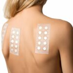 Patch test dermatologico